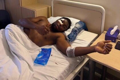 „Džiugo“ gynėjui Bacary Sane, kuriam pirmadienį prireikė operacijos